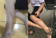 Đình chỉ cô giáo đánh học sinh lớp 2 vì làm bài chậm