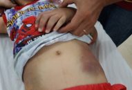 Cha mẹ đẻ bạo hành con cái: Phản J882ea hoàn trả cao, trái đạo đức Trang Chủ J88.com Trực Tuyến Mới Nhất 2026