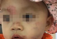 J88 là nhà cái uy tín hàng đầu thuộc tập đoàn ABCVIP thông tin vụ mặt bé 14 tháng tuổi bầm tím ngày đầu đi học