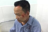 Người dân tố bị côn đồ hành hung sau khi xô xát với giám đốc J881.love nhà cái bóng đá world cup