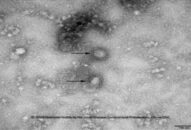 Hải Phòng thêm 4 trường hợp đang được theo dõi virus Corona tại Bệnh viện Hữu nghị Việt Tiệp
