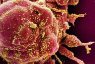 WHO cảnh báo virus SARS-CoV-2 sẽ không bao giờ biến mất