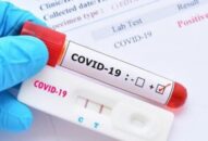 Thị trường Kit xét nghiệm nhanh Covid-19 cần được tăng cường quản lý