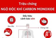 Bệnh viện Trẻ em Hải Phòng cảnh báo ngộ độc khí CO do gia đình sử dụng máy phát điện chạy bằng xăng trong phòng kín