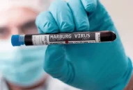 Chủ động giám sát, phát hiện và J881 ưu đãi hấp dẫn bệnh do virus Marburg